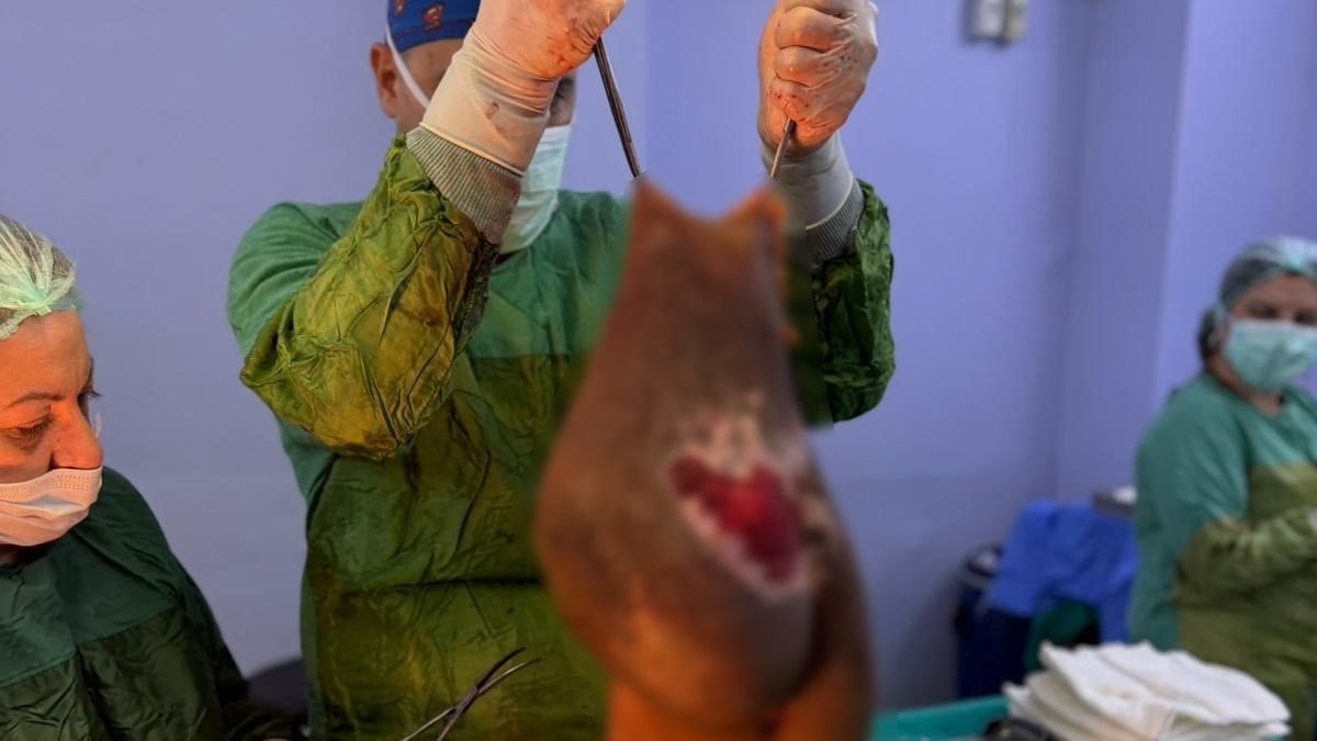 Aydın'da yaşayan bayanın karnından 40 kilogram kitle çıkarıldı