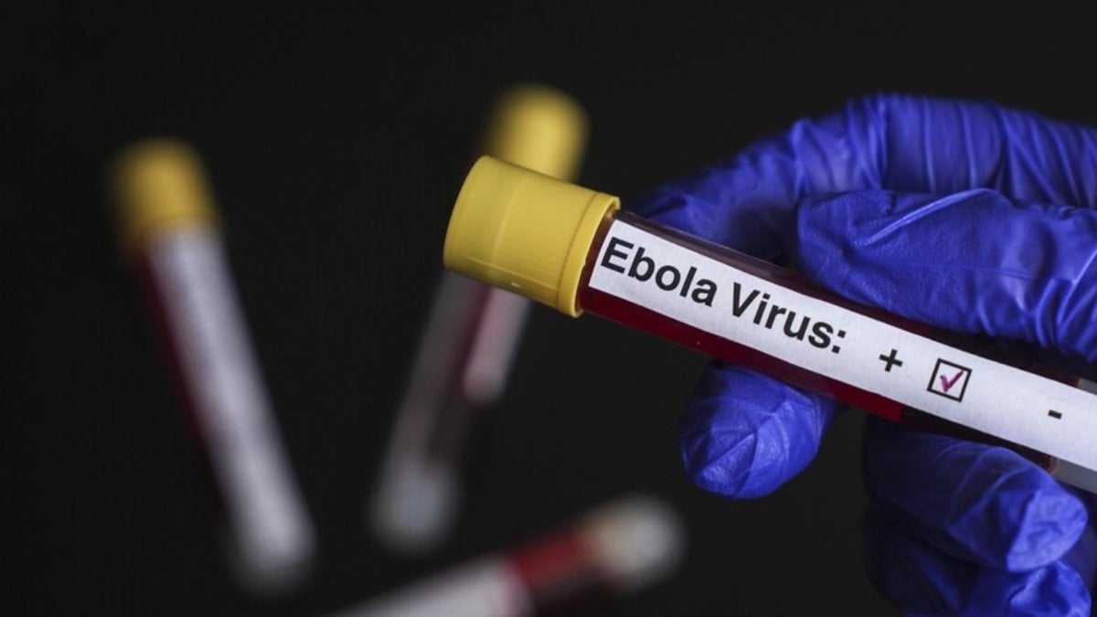 Fransa birinci Ebola hadisesini açıkladı