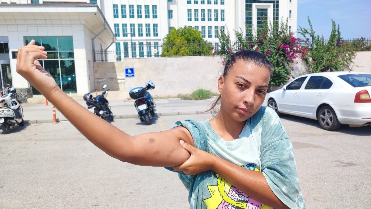 Adana'da cankurtaran bayan, öğretmen amcası tarafından darbedildi
