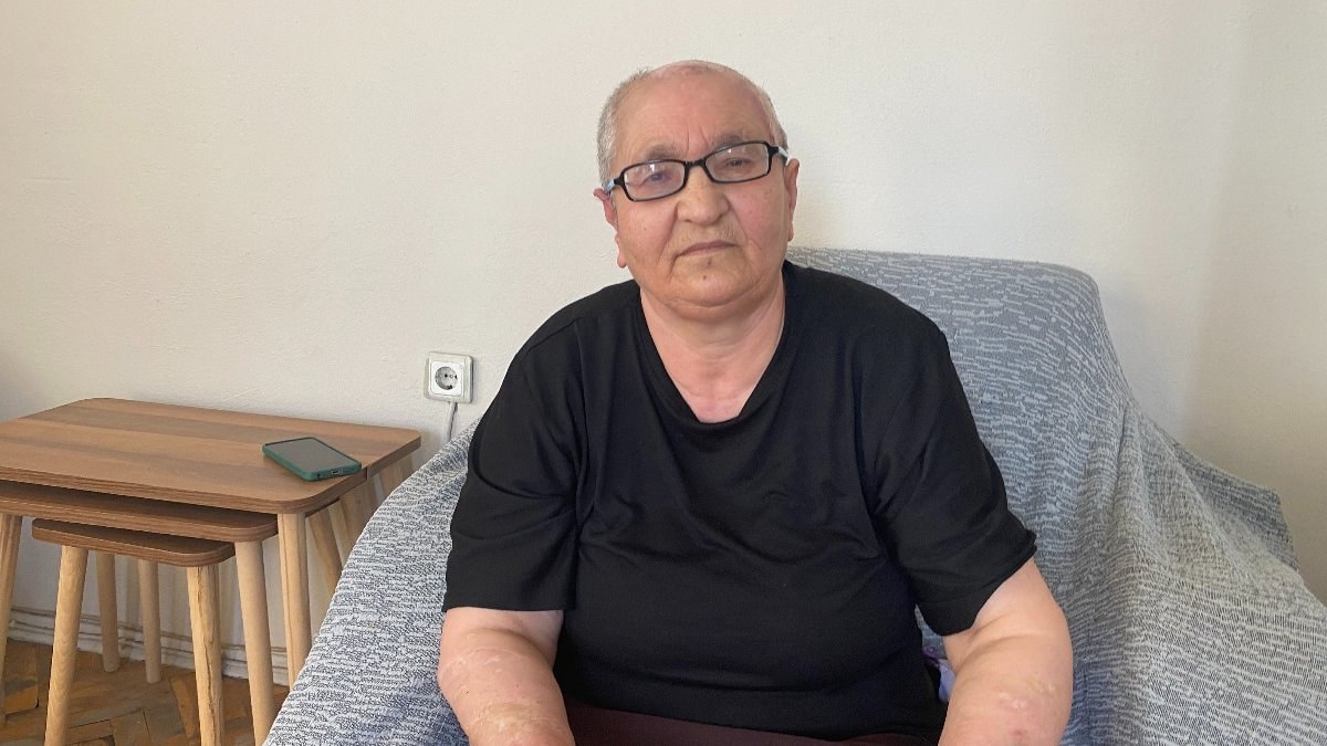 Kırşehir'de köpeğin saldırdığı bayan tazminat alacak: Hakkınızı arayın