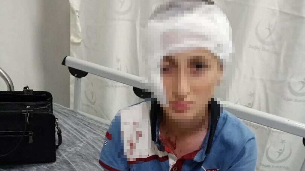 İzmir'de köpek taarruzunda yaralanan çocuğa tazminat ödenecek
